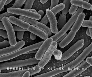 E. coli Outbreak Forces Shutdown of Beloved Tri-State Lake Swimming Spot
